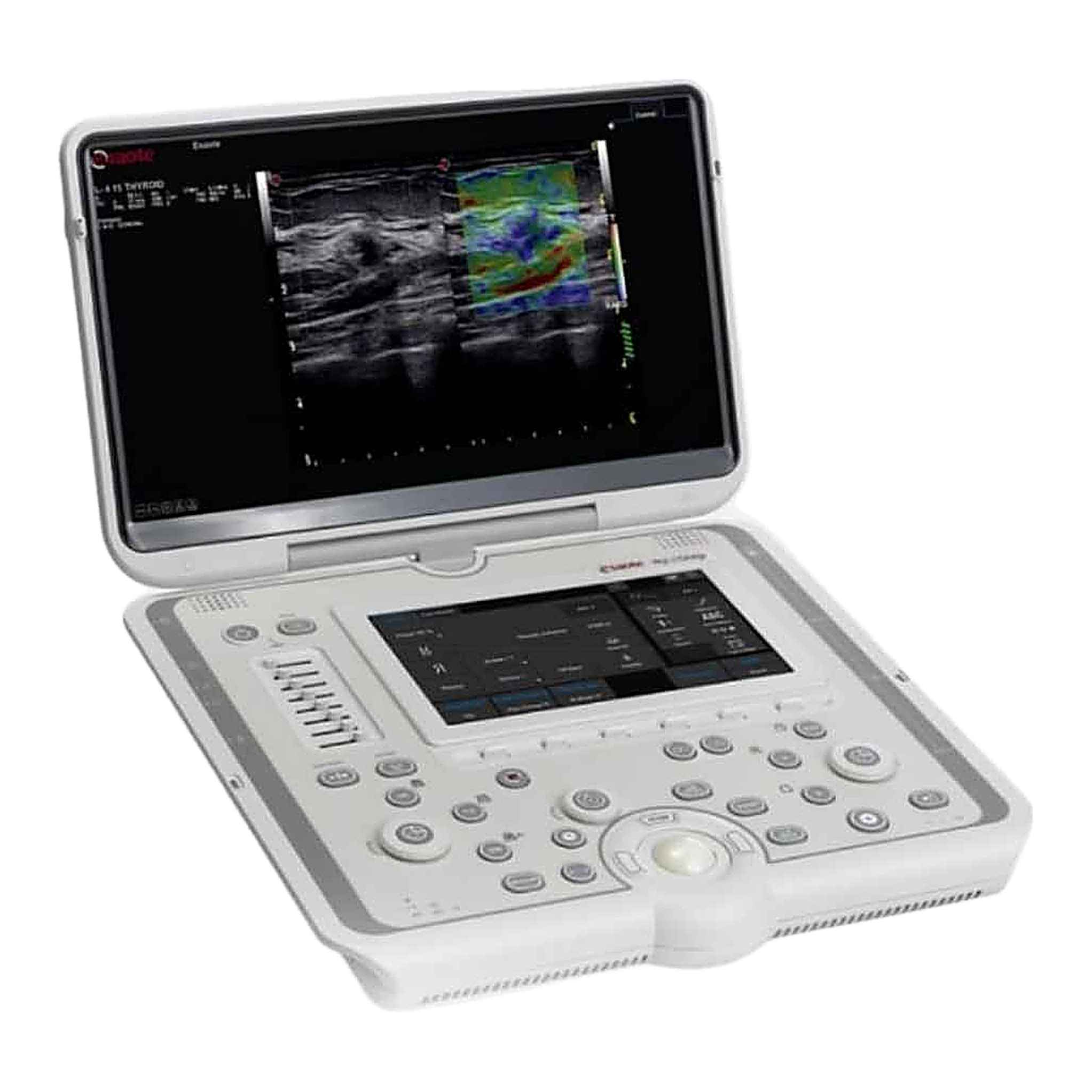 Colour Doppler